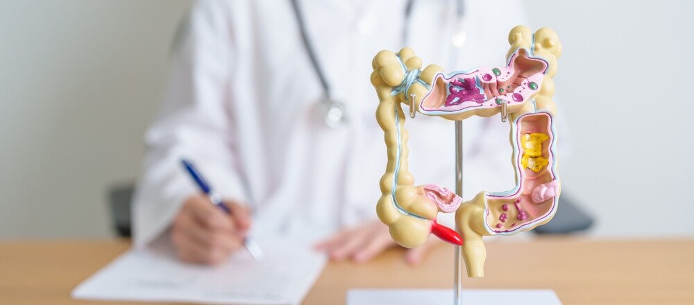colon graphic with doctor taking notes